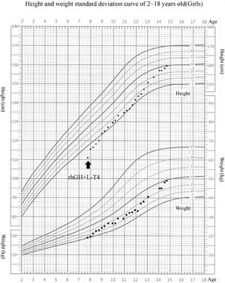 Clinical Characteristics and Long-Term Recombinant Human Growth Hormone Treatment of 18q- Syndrome: A Case Report and Literature Review